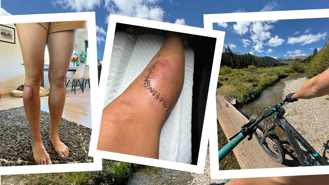 what-its-like-arterial-gash